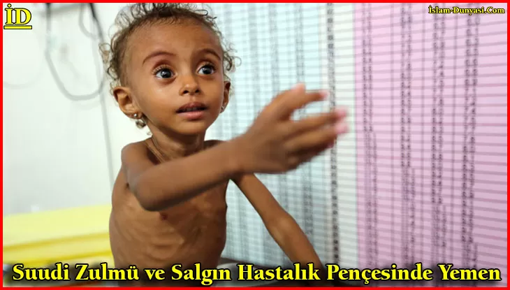 Suudi Zulmü ve Salgın Hastalık Pençesinde Yemen