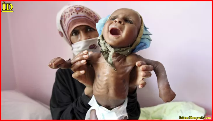 Yemen’de 12 Milyon Çocuk Yardıma Muhtaç
